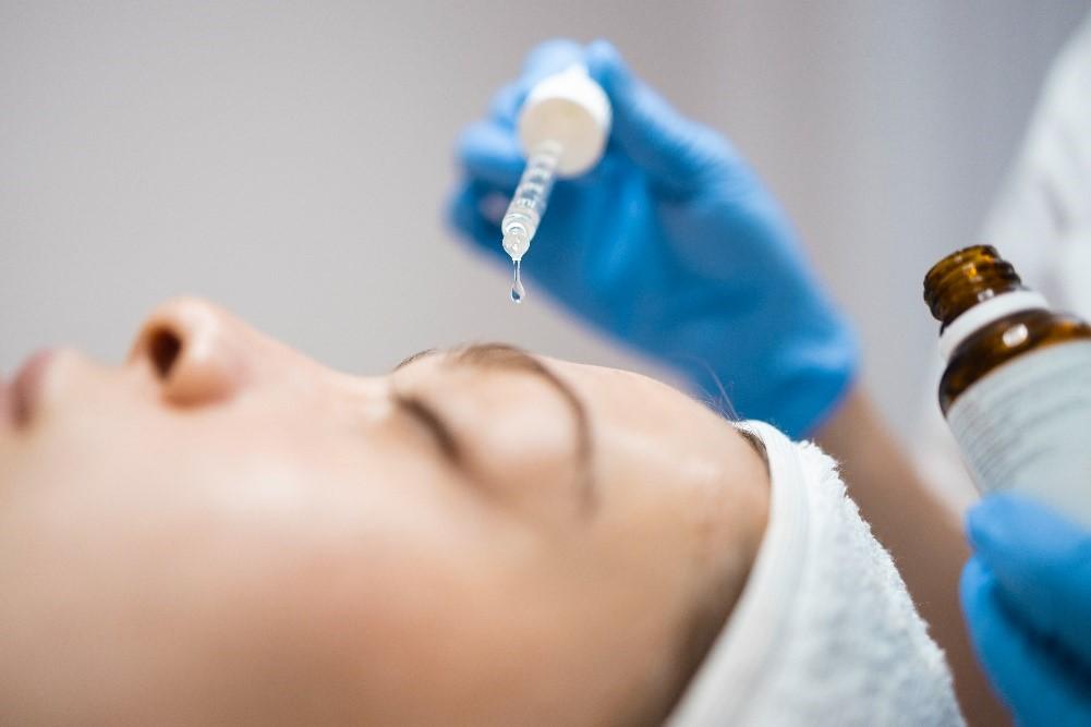 Chemical Peels